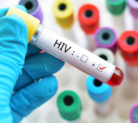 WHO’dan HIV Programları İçin Fon Kesintisi Uyarısı